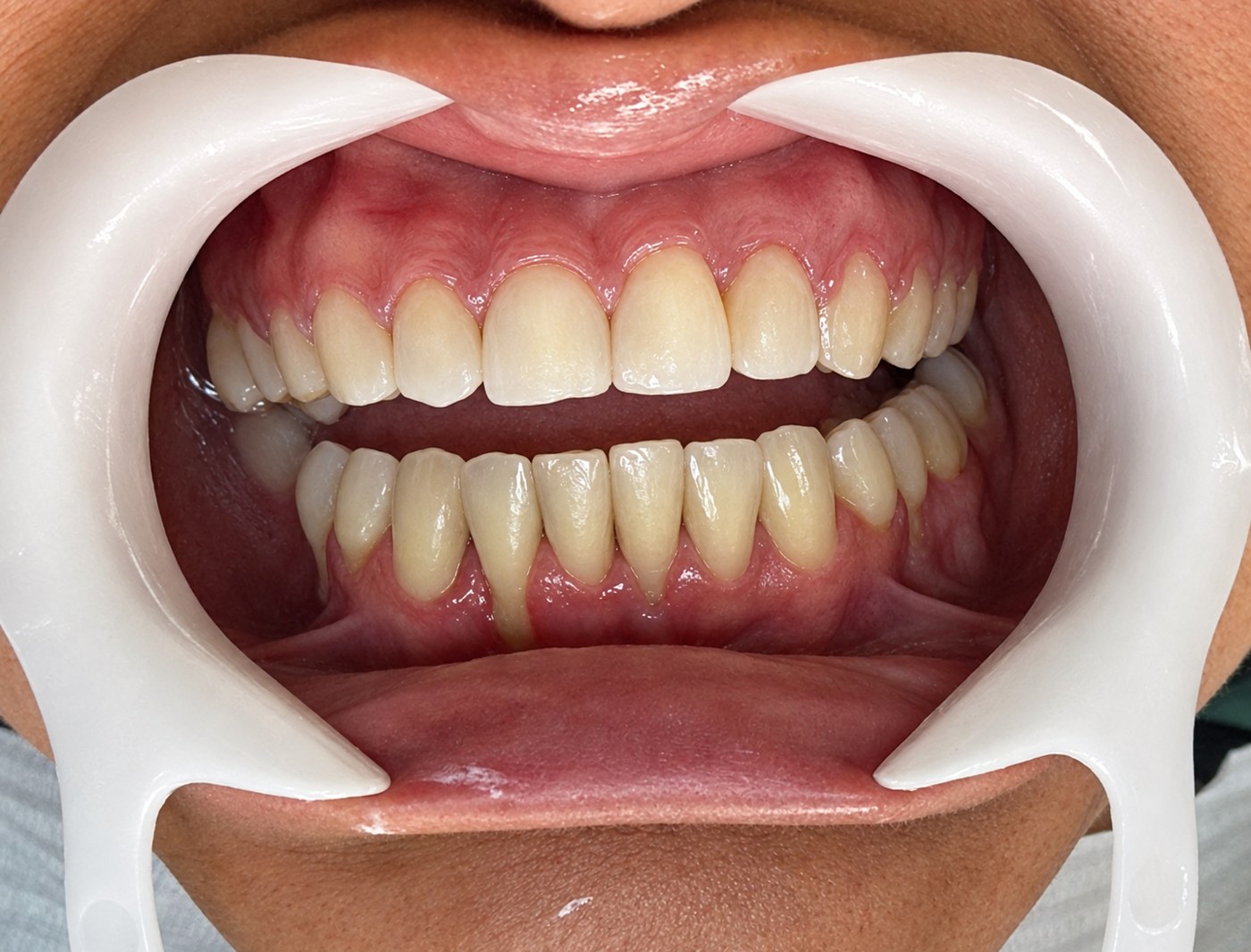 Registro clínico dos dentes enviado pela clínica