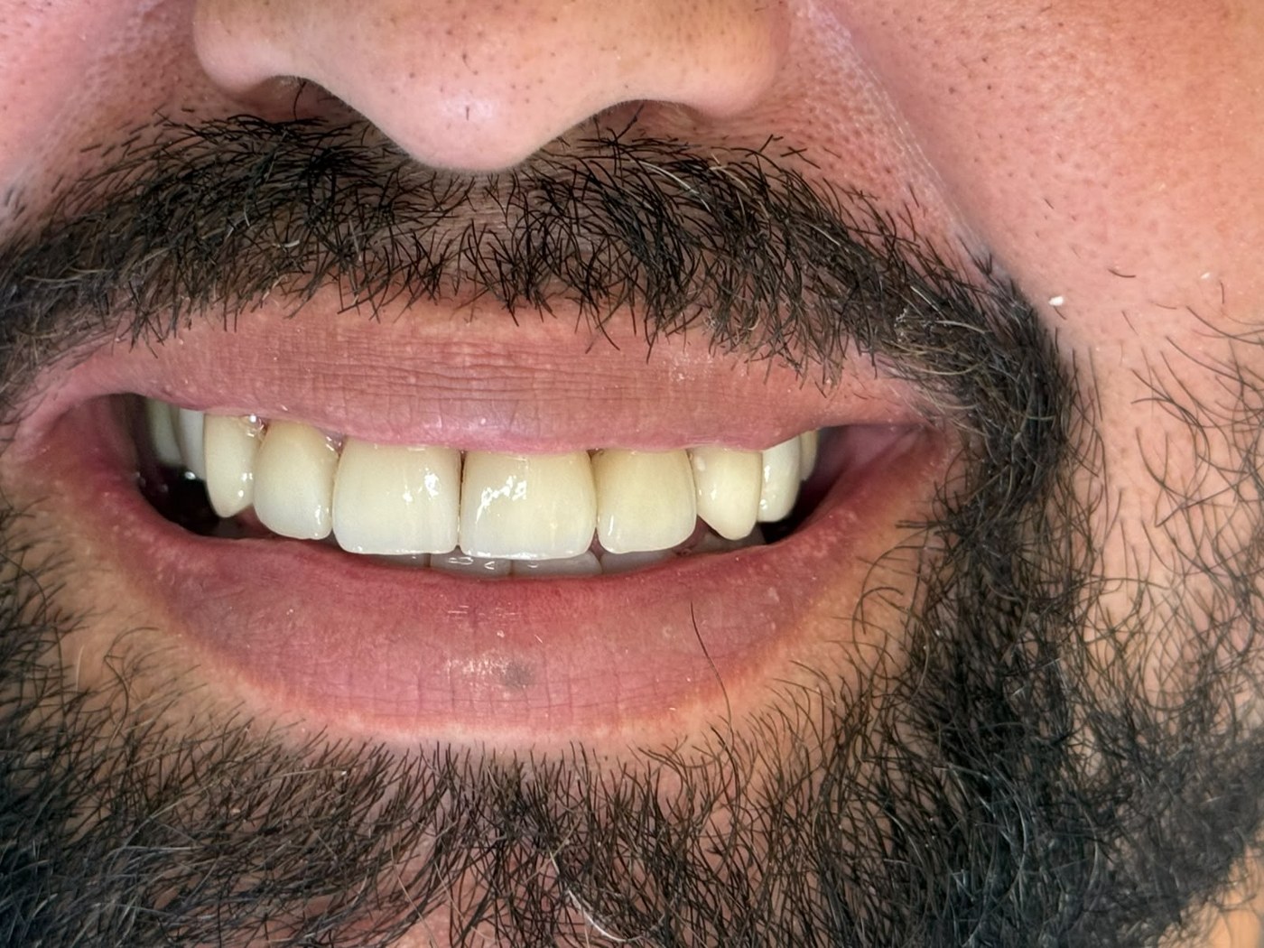 Fotografia aproximada de um sorriso enviada pela clínica